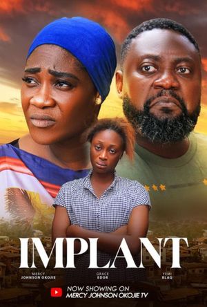 Implant poster